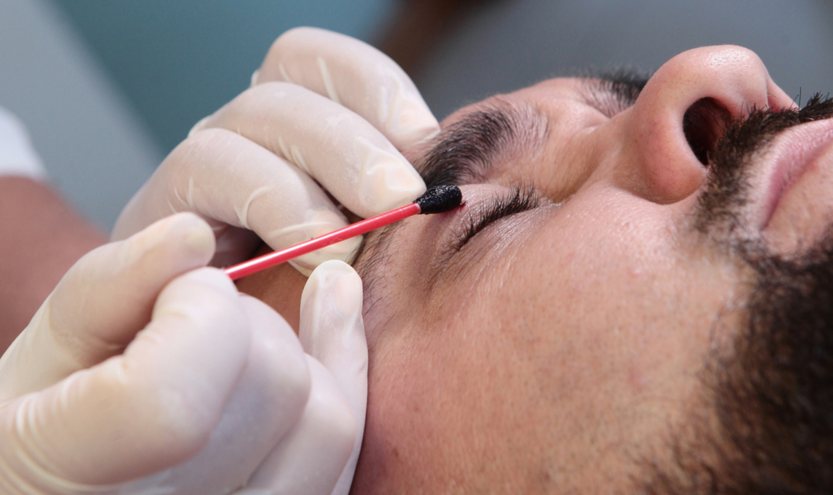 a picture of a man being treated with betadine