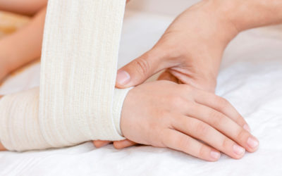 Ultimate Guide to Treating a Sprained Wrist