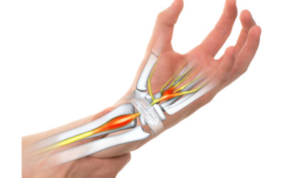 Carpal Tunnel vs. Arthritis: What’s the Difference?