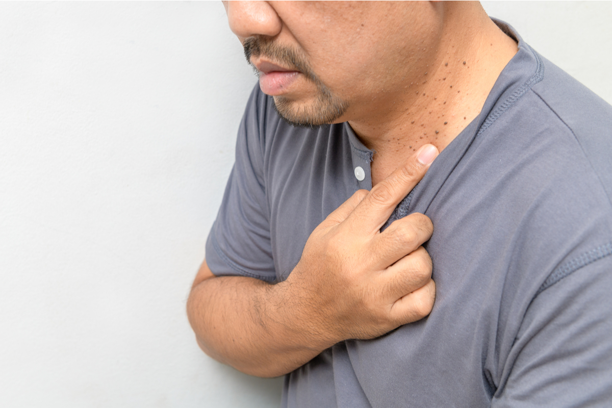 Skin Tag vs Wart How To Tell the Difference Hempvana Learning Hub