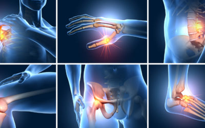 Sudden Onset Joint Pain in Multiple Joints